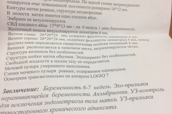 Тор браузер omg